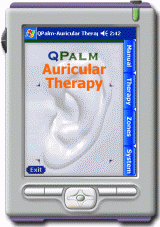 qpalm auricular 1 0 for pocket pc pda applications auricular acupuncture chart download