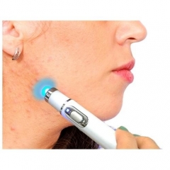 Blue Light Acne Removal Pen