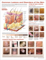 Common Lesions and Disorders of the Skin Laminated Anatomical Chart, 3rd Edition