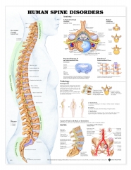 Human Spine Disorders