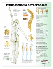 Understanding Osteoporosis