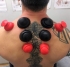 Rock Tape RockPods Cupping Set